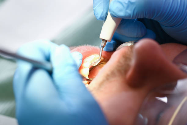 Best Walk-In Emergency Dentist in Mvell, AR