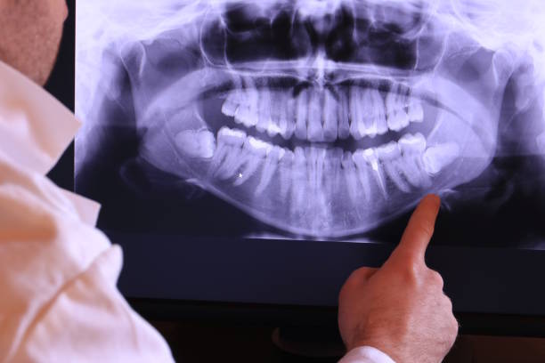 Best Emergency Broken Tooth Repair in Mvell, AR